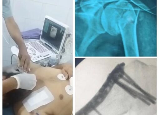 لأول مرة.. فريق طبي ينجح باجراء عملية نوعية باستخدام التخدير الطرفي