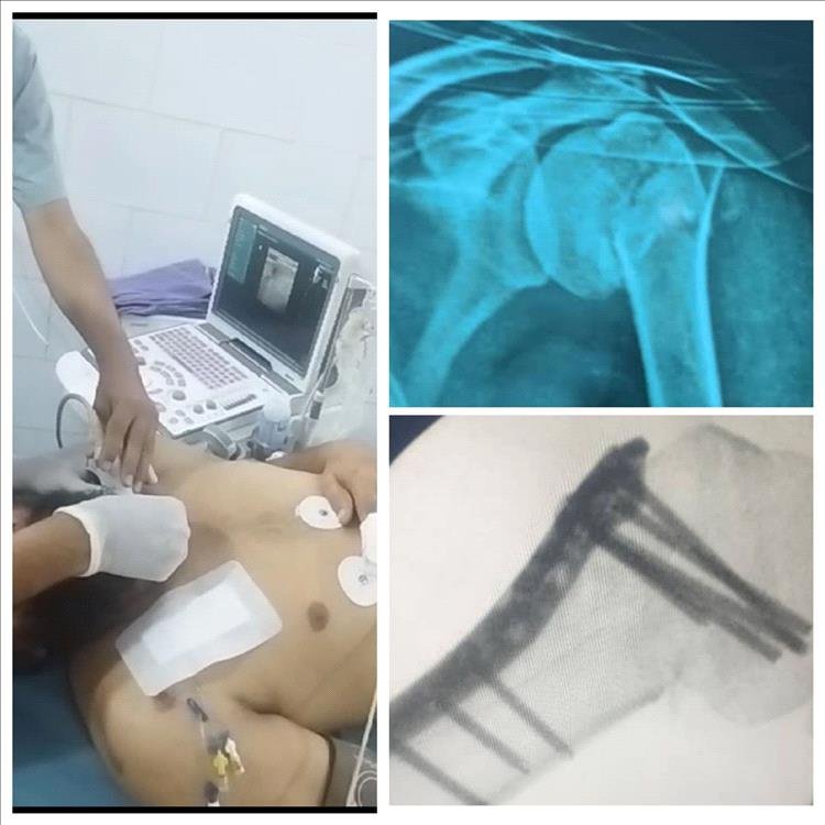 لأول مرة.. فريق طبي ينجح باجراء عملية نوعية باستخدام التخدير الطرفي