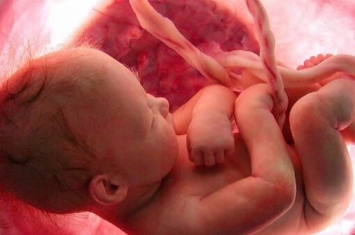 في حالة نادرة للغاية .. أطباء يعثرون على جنينين في بطن جنين برحم أمه