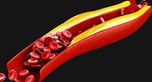 هذه الوجبة تعالجه الكوليسترول في 30 يومًا.. تعرف عليها