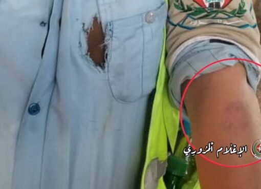 شرطة المرور في صنعاء تفاجئ الجميع بهذه العقوبات وتنشر تفاصيل الحادثة