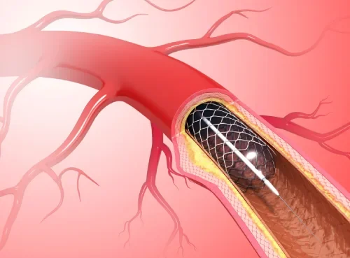 "مختص" يكشف عن 10 أطعمة تفتح الشرايين وتمنع انسدادها