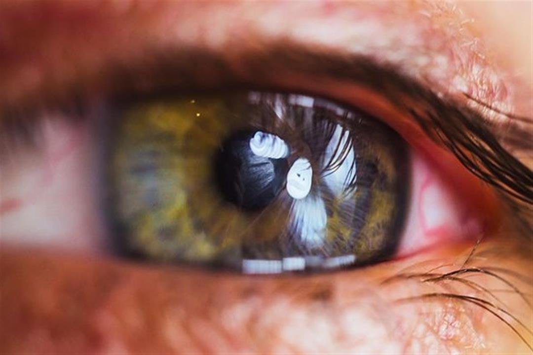 كيف تؤثر صوم رمضان على صحة العين؟ نصائح من الخبراء