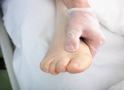 استشاري يكشف أسباب تورم أقدام مرضى الضغط