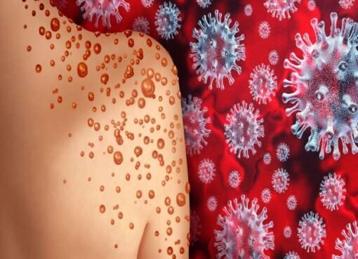 وباء جديد يهدد العالم.. إليك الأعراض وسبل الوقاية من الخطر القادم