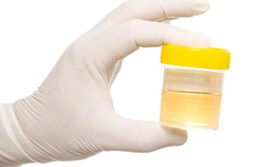 احذر.. خروج رغوة مع البول قد يكون جرس إنذار لأمراض خطيرة