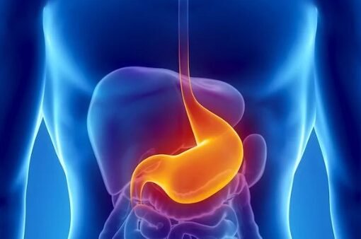 تعرف على أعراض سرطان المعدة