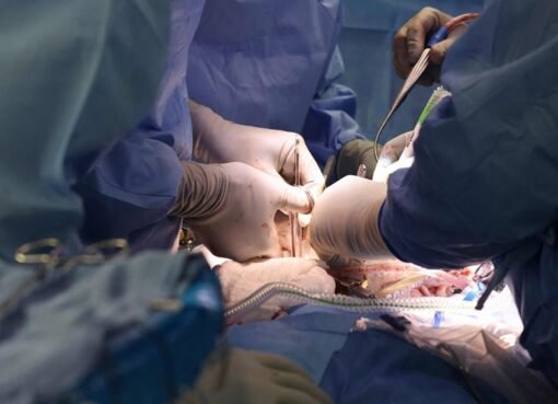 إنجاز طبي عالمي: مريضة تسجل رقماً قياسياً بكلية خنزير معدلة وراثياً