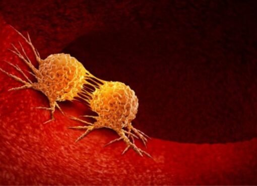 وداعًا للخلايا الخبيثة: اكتشف 6 مشروبات طبيعية قوية تُعيق نشاط السرطان في جسمك!