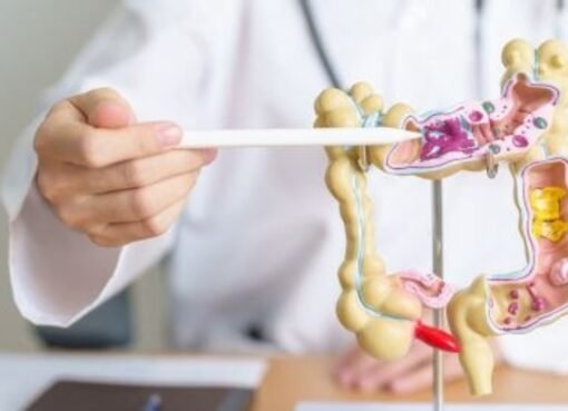 تحذير طبي عاجل: علامات شائعة تدل على سرطان القولون.. وهذه 5 أطعمة هي الحل!