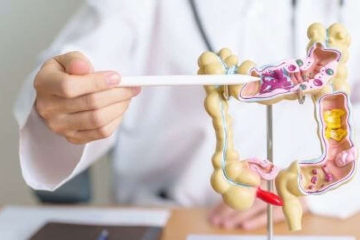 تحذير طبي عاجل: علامات شائعة تدل على سرطان القولون.. وهذه 5 أطعمة هي الحل!