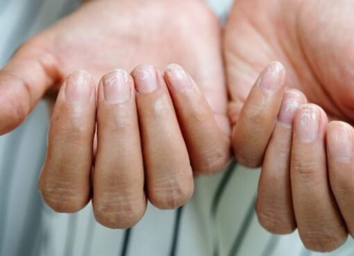 يدك تخبرك بالخطر: علامات غريبة على راحة يدك قد تنذر بأمراض خطيرة!