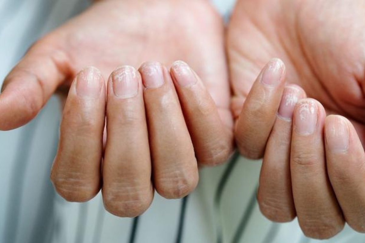 يدك تخبرك بالخطر: علامات غريبة على راحة يدك قد تنذر بأمراض خطيرة!