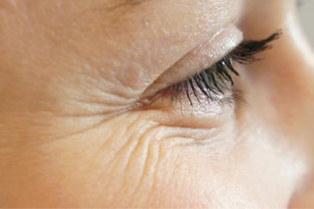 أطعمة ومشروبات تسرّع التجاعيد... احذرها قبل فوات الأوان!