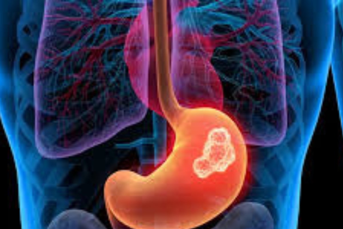 وداعًا للحموضة! اكتشف أقوى 7 أطعمة للحماية من حرقة المعدة