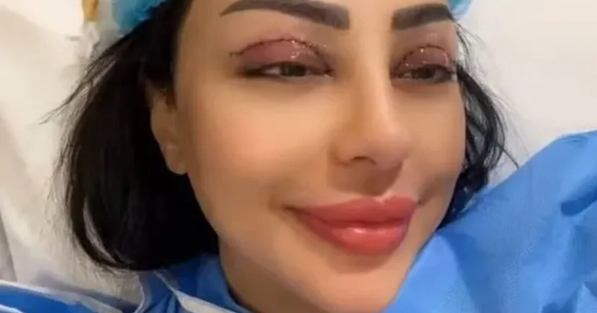 فنانة يمنية تخضع لعملية قص الجفون وتكشف عن تحول جريء!
