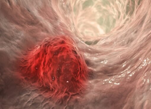 لا تتجاهلها.. ظهور واحدة من هذه العلامات قد يعني أنك مصاب بالسرطان