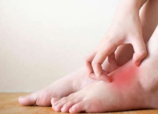 علامات تحذيرية في ساقيك قد تشير لأمراض القلب.. لا تتأخر بزيارة الطبيب!