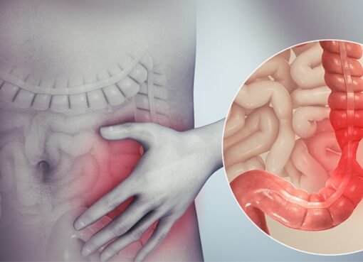 فتاة مصرية تفاجئ الجميع بعشبة خارقة... تحارب السرطان وتُريح القولون!