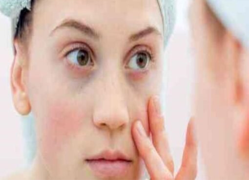 وجهك يكشف السر: علامة بسيطة قد تدل على ورم خطير.. تعرف عليها الآن!