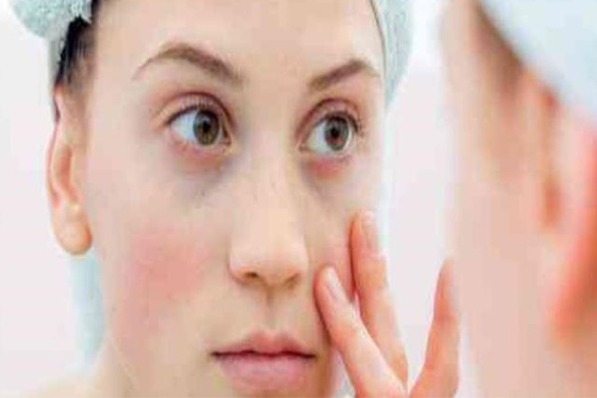 وجهك يكشف السر: علامة بسيطة قد تدل على ورم خطير.. تعرف عليها الآن!