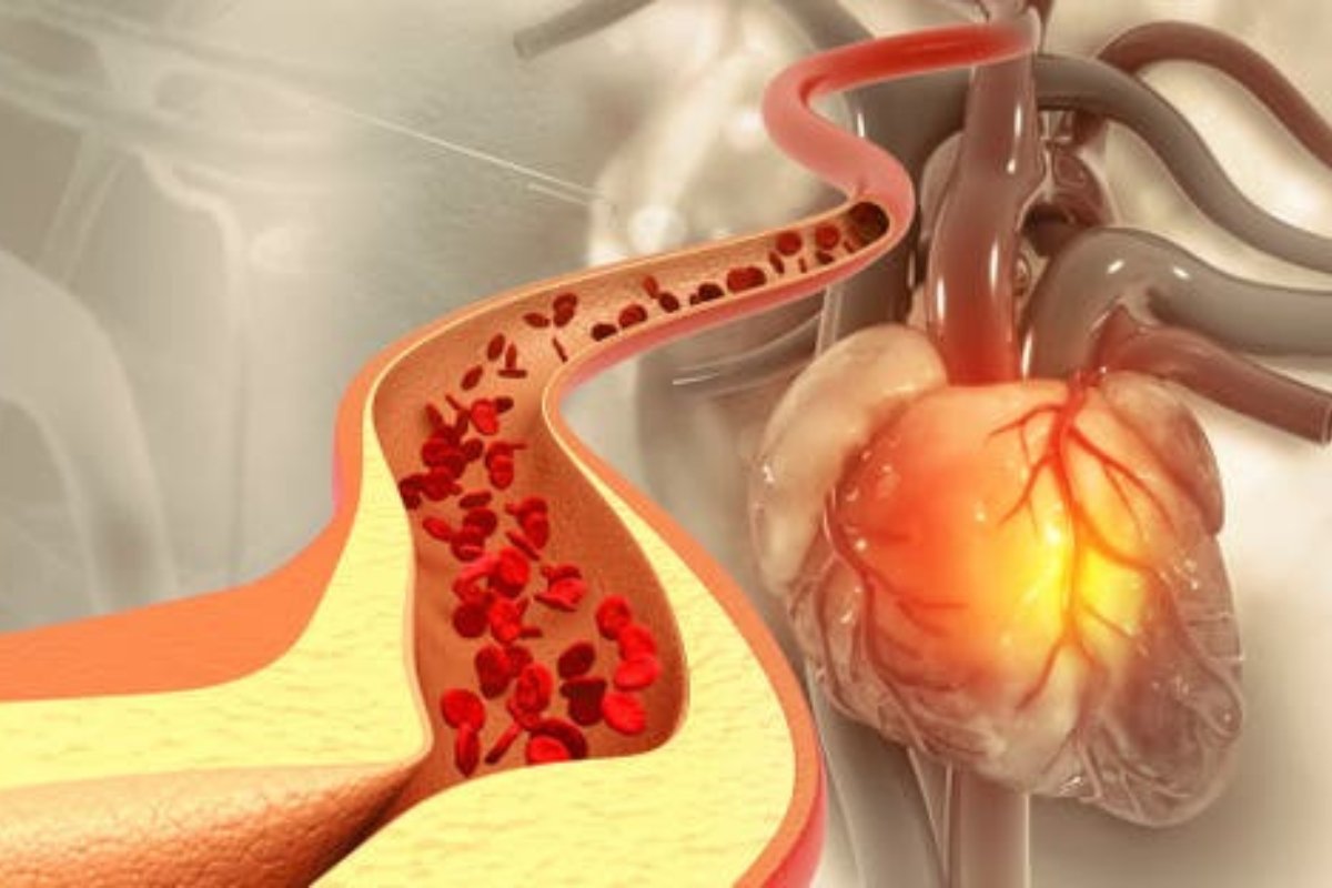 أطعمة خارقة تخلصك من الكوليسترول وتحمي قلبك مدى الحياة