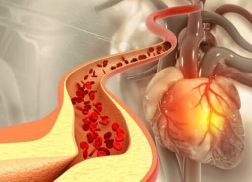 أطعمة طبيعية تحارب الكوليسترول الضار: 5 خيارات لصحة قلبك