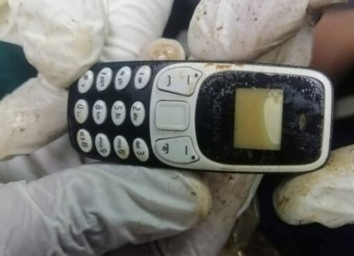 ابتلعه قبل عامين.. استخراج هاتف من معدة مواطن مصري دون جراحة!