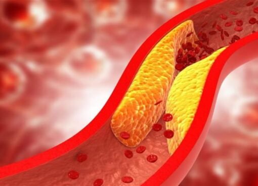 بدون أدوية: طرق طبيعية فعالة لتقليل الكوليسترول في 30 يوماً