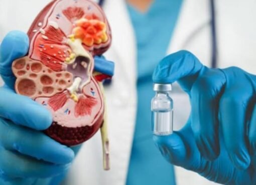 أنقذ كليتيك الآن: 8 عادات تمنع الفشل الكلوي قبل أن يتفاقم الخطر