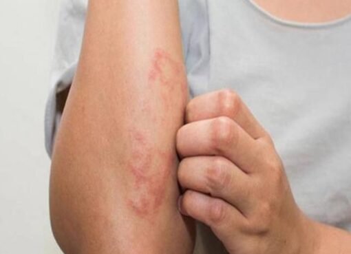 إذا ظهرت عليك هذه الأعراض.. راجع الطبيب فورًا فقد تكون بداية السرطان