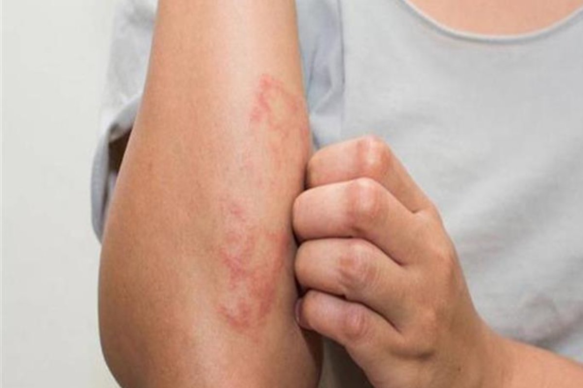 إذا ظهرت عليك هذه الأعراض.. راجع الطبيب فورًا فقد تكون بداية السرطان