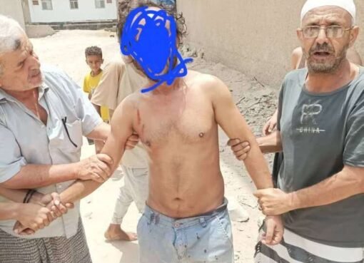 مفاجأة داخل الشقة: لص غارق في النوم تحت التكييف بعد اقتحامها