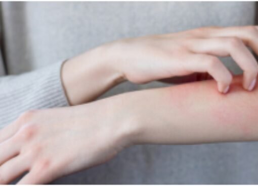 تحذير صحي: خطأ شائع في الفنادق قد ينقل لك الجرب دون أن تدري!