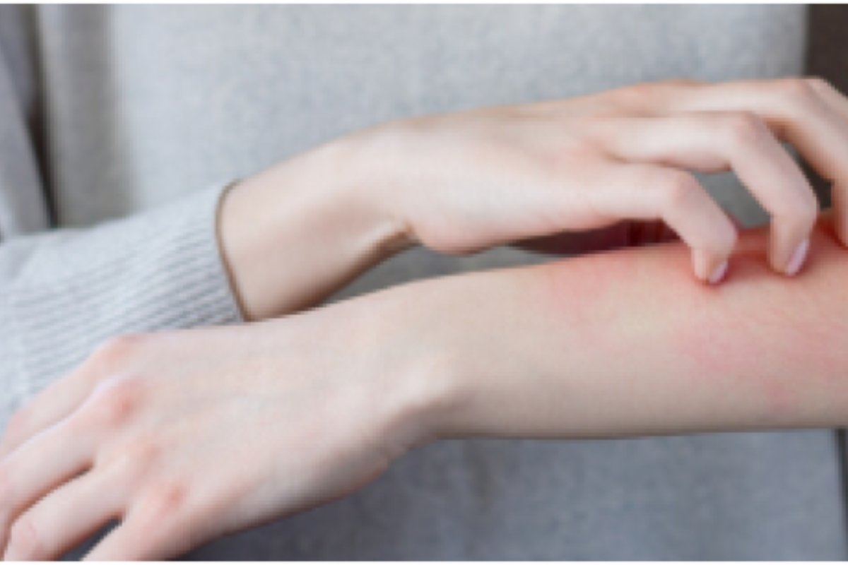 تحذير صحي: خطأ شائع في الفنادق قد ينقل لك الجرب دون أن تدري!