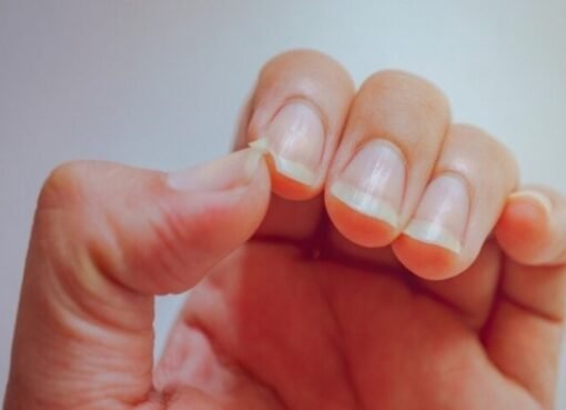 أظافرك تنذرك بالخطر.. 10 إشارات لا تتجاهلها