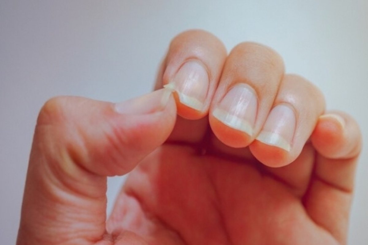 أظافرك تنذرك بالخطر.. 10 إشارات لا تتجاهلها