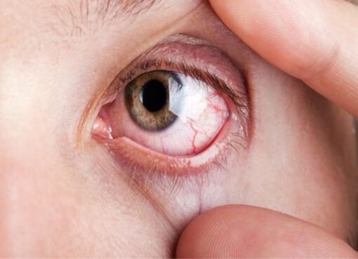 عيونك تتكلم عن قلبك.. إشارات خطيرة تُنذر بمشكلة قلبية