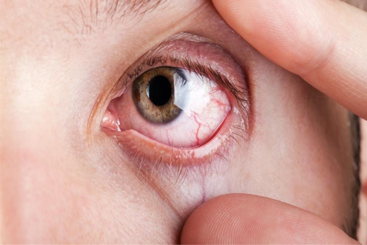 عيونك تتكلم عن قلبك.. إشارات خطيرة تُنذر بمشكلة قلبية