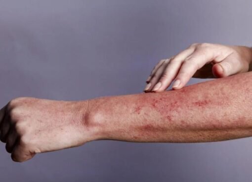 لأول مرة في السعودية: علاج ثوري للإيدز يدخل الخدمة.. إليك طريقة استخدامه