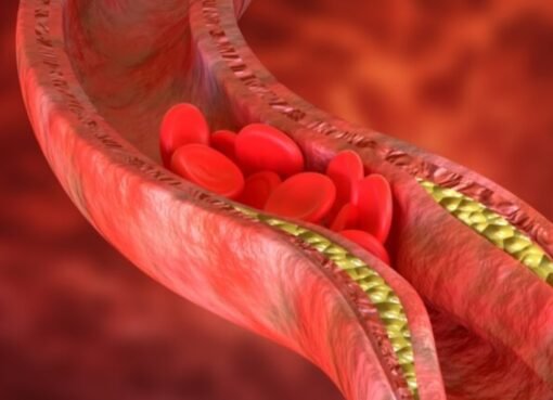 غذاء واحد يُحدث ثورة في الطب... ينظّف الشرايين خلال أيام!