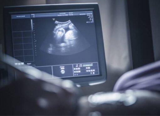 اكتشاف مذهل: جنين داخل بطن سيدة منذ 40 عامًا!