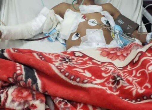 بطل الجمهورية في الكونغ فو ينجو من الموت إثر قصف صاروخي بصنعاء