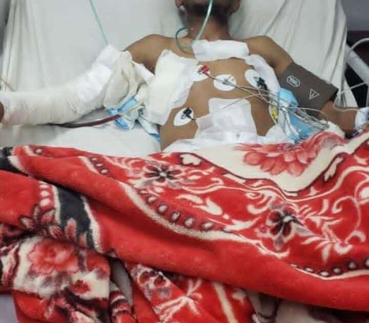 بطل الجمهورية في الكونغ فو ينجو من الموت إثر قصف صاروخي بصنعاء