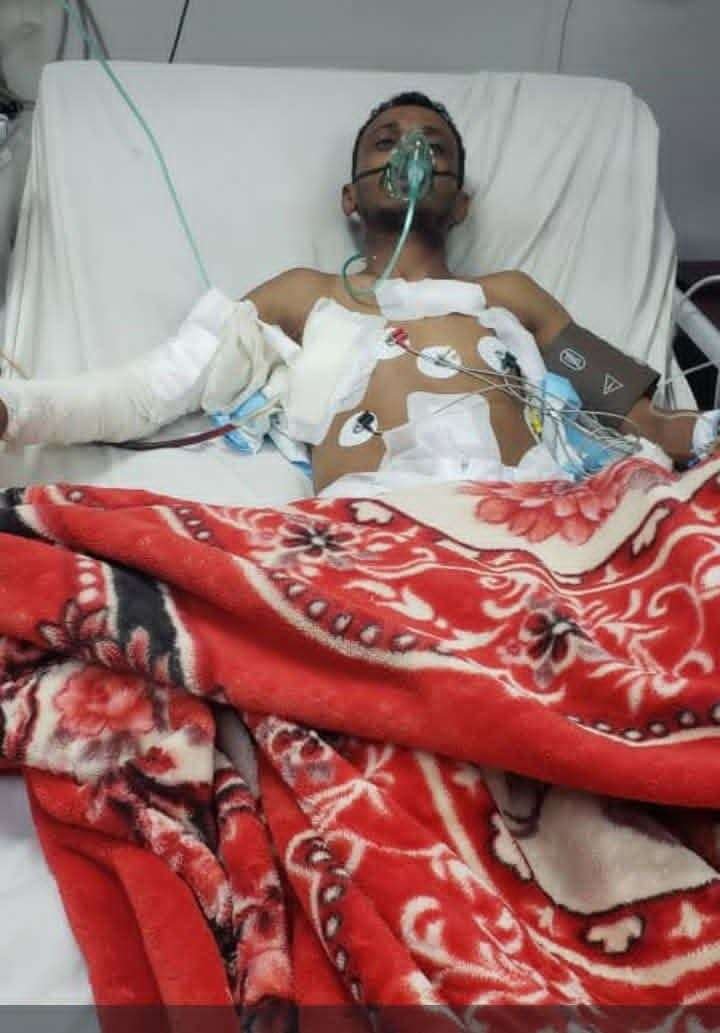 بطل الجمهورية في الكونغ فو ينجو من الموت إثر قصف صاروخي بصنعاء