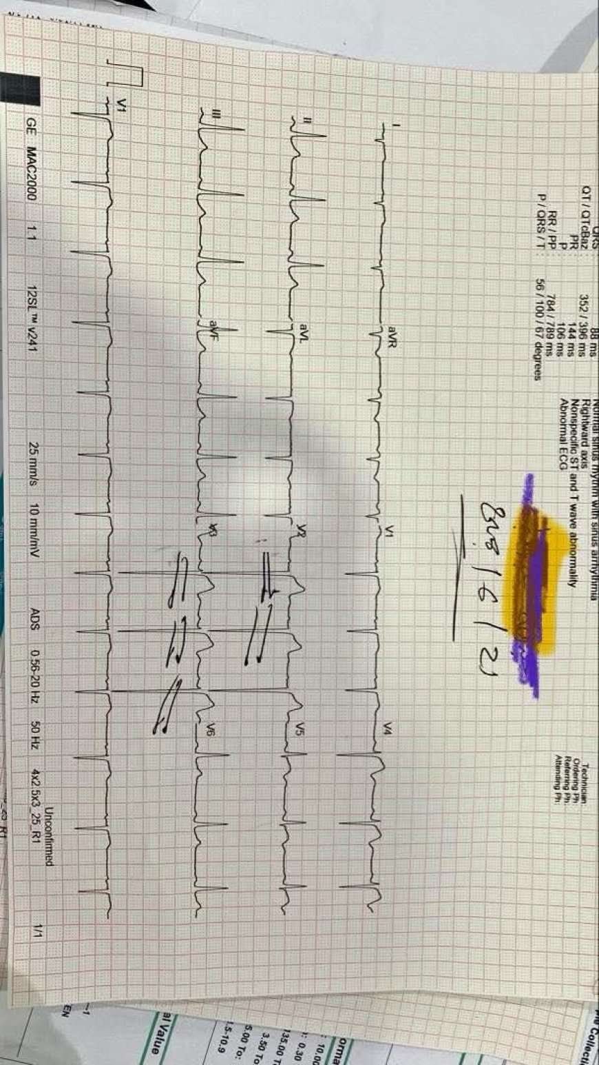 منتج غامض يتسبب بجلطات قلبية… والطبيب الماتري يطالب بتدخل عاجل